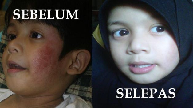 Herba Adalah Penawar Pelbagai Penyakit. : RUAM BAYI POWDER 