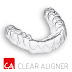 Top những đặc điểm nổi trội khi niềng răng clear aligner