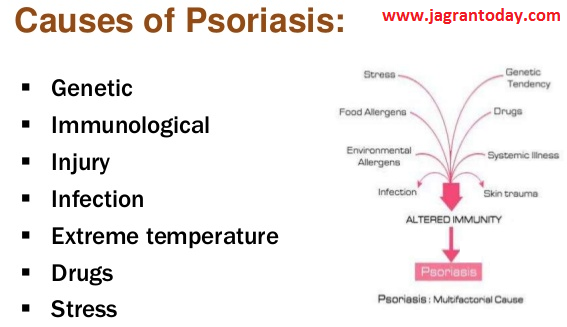 Causes and Symptoms of Psoriasis