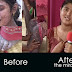 Sindhuja - Terrible skin disease Healed ( Video )