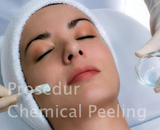 Menghilangkan Jerawat dengan Chemical Peeling