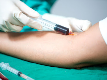 Blood Stream Infection Testing