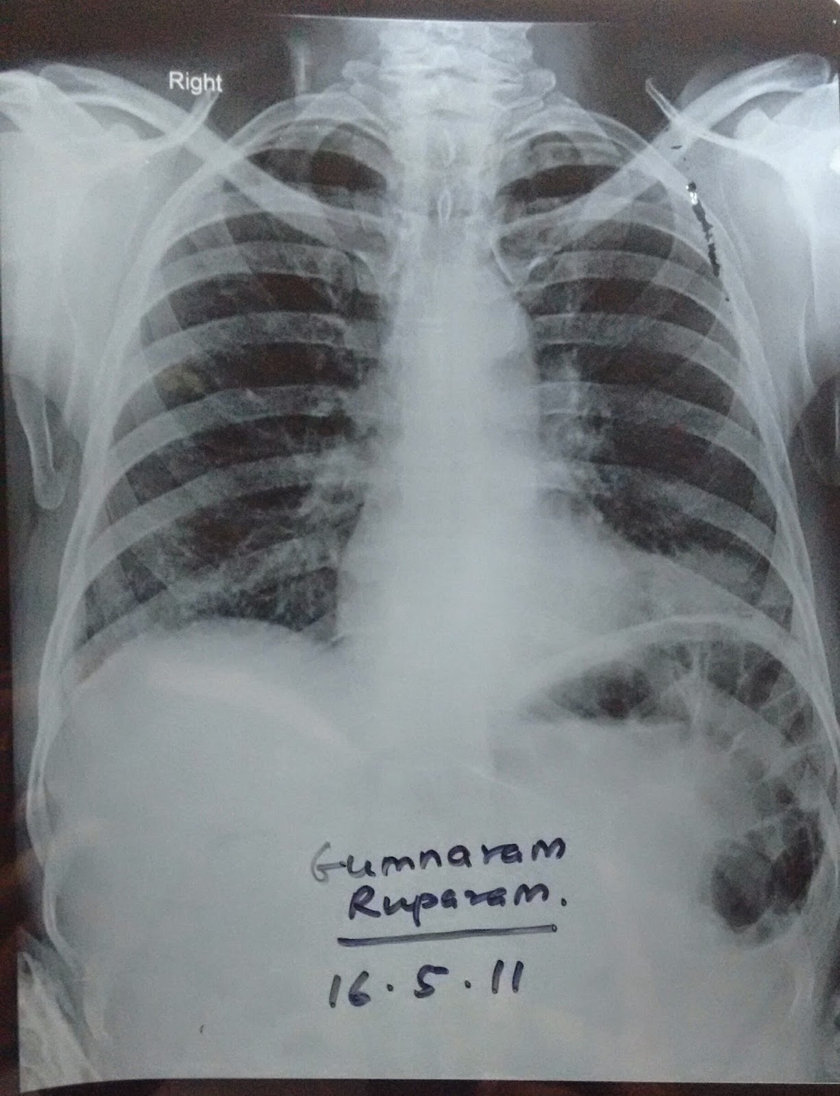 Chest X-ray Interpretation and Beginners Anatomy - Etsy