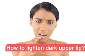 How to Lighten Dark Upper Lips ?