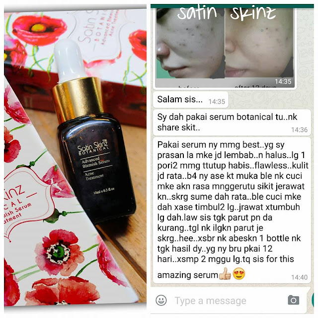 Satin Skinz Facial Acne Cream / Satin Skin Botanical (Acne) Serum Murah