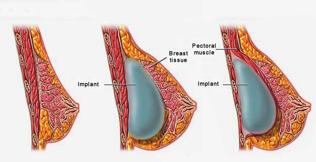 Using Massage for Natural Breast Enlargement