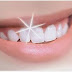 Gigi putih bersih bersinar