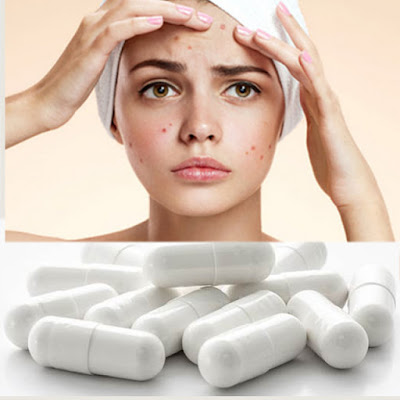 can-glutathione-reduce-or-prevent-pimples-and-acne