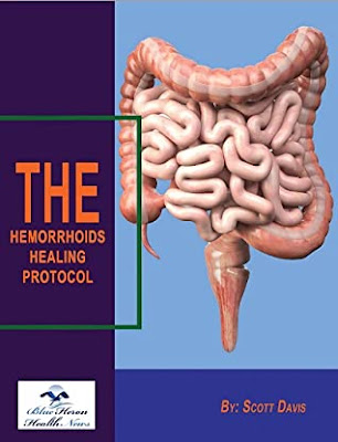 The Hemorrhoids Healing Protocol eBook Reviews PDF
