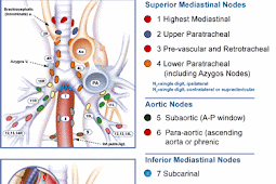 LUNG CANCER STAGING