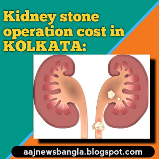Kidney stone operation cost in Kolkata