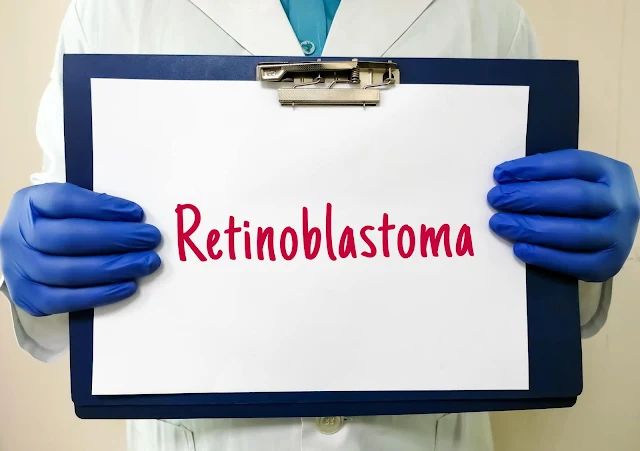 The Impacts of Retinoblastoma on Eyesight