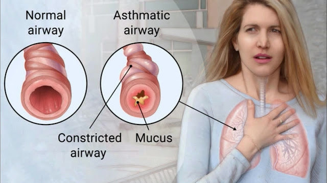 http://aayushiayurveda.com/respiratory-disorders/ayurvedic-treatment-for-asthma/