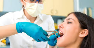 What should you rinse with after a tooth extraction?