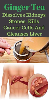 GINGER TEA: DISSOLVES KIDNEY STONES, CLEANSES LIVER & OBLITERATES CANCER CELLS (RECIPE)