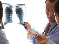 Mesothelioma Cancer Is An Extremely Rare and Fatal Form Of This Horrifying Disease