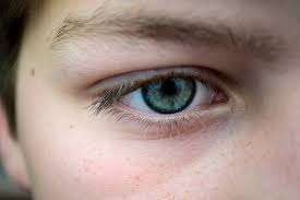 Mata minus tidak ada hubungan dengan fungsi retina mata yang sel-sel sarafnya terganggu seperti yang terjadi apabila kekurangan vitamin A, sehingga kemampuan melihat terang-gelapnya terganggu. Kasus kekurangan vitamin A disebut rabun senja, mata sudah menurun ketajamannya khas terjadi setelah matahari terbenam saja, namun normal kalau bukan saat setelah senja. Kasus ini bisa diatasi dengan tambahan vitamin A, atau asupan makanan dan minuman yang kaya akan vitamin A, khususnya wortel. Bila kasus ini dibiarkan berlanjut, mata bisa buta. Kebutaan sebab kekurangan vitamin A di kita khususnya pada usia anak dulu masih banyak sekali dulu, karena terlambat diberi tambahan vitamin A.