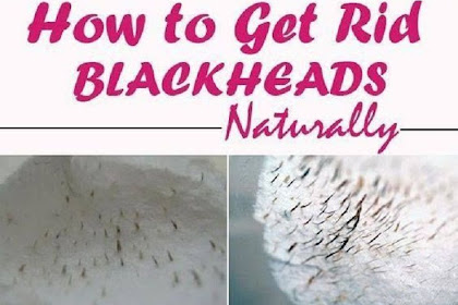 BLACKHEADS: Get Rid Of Blackheads Permanently With a Help Of This Simple Trick