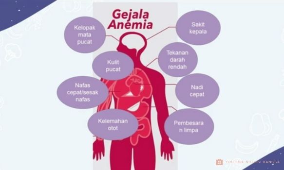 Gejala Anemia