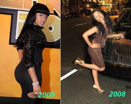 Nicki Minaj before and after butt implants plastic surgery
