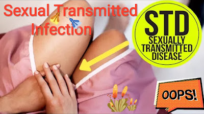 Sexual Transmitted Infection