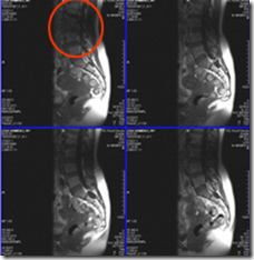 image_thumb4