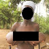 11 year old girl with strange massive breasts undergoes 7-hour surgery