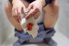 পুরুষের পায়খানার সাথে রক্ত পড়া কিসের লক্ষণ