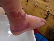 Jordan black and blue ankle