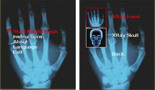 XRay Scanner picture