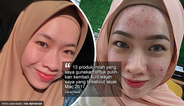 13 produk ini saya gunakan untuk pulihkan kulit muka 