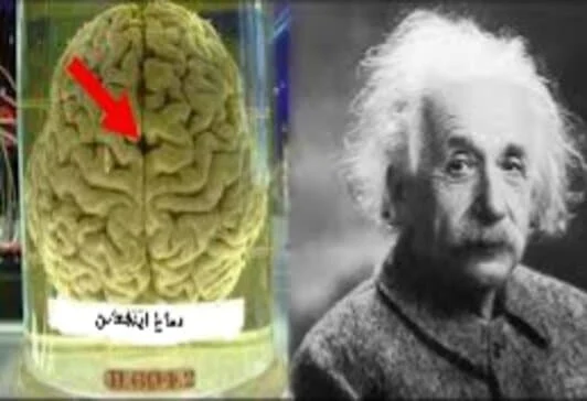 هل فعلا دماغ أينشتاين يختلف عن دماغ الإنسان العادي