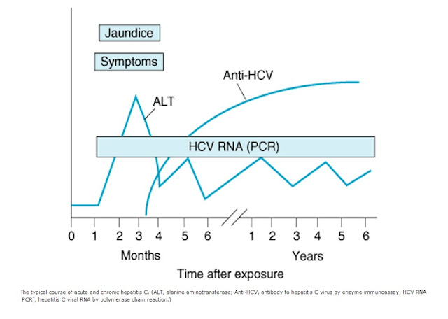 Kurva Diagram perjalanan manifestasi klinis laboratoris penyakit hepatitis C jumlah antibodi terhadap waktu HCV RNA PCR Jaundice gejala symptoms Anti-HCV, polymerase chain reaction, bulanan, tahunan, tahun