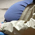 Obesity harms 'later brain skill'