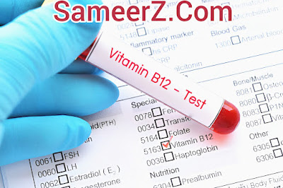 Top Vitamin B 12 deficiency signs and symptoms