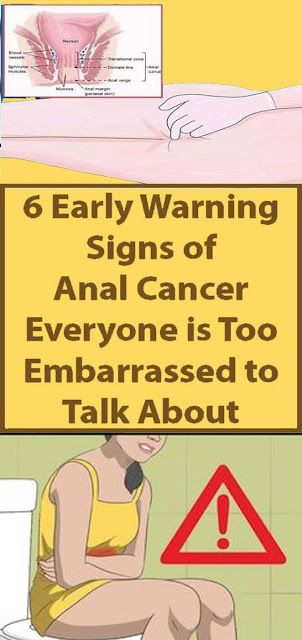 6 Unusual Signs of Anal Cancer You Shouldn’t Ignore