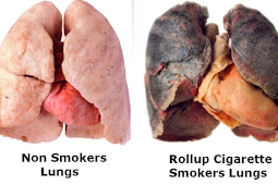 How Smoking Affects Your Health