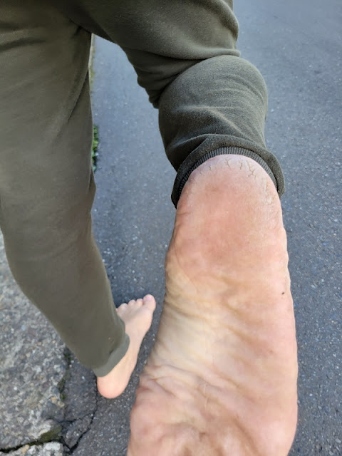 厚皮是赤脚生活的证明，我以身为赤脚族为荣。