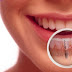 Những biến chứng khi cấy ghép răng Implant không đúng quy trình