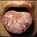 jual obat kencing nanah di surabaya di ebay.com