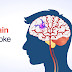 4 Signs and Symptoms of Brain Stroke