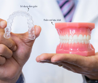 Niềng răng invisalign bao nhiêu tiền-4