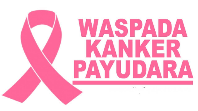 Kanker payudara yakni salah satu jenis kanker yang paling umum  9 Cara Mencegah Kanker Payudara, Penting Untuk Wanita Apalagi Remaja