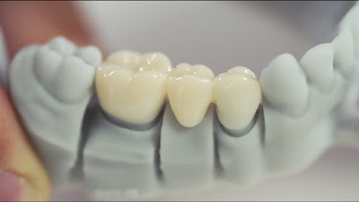 Global Dental 3D Printing