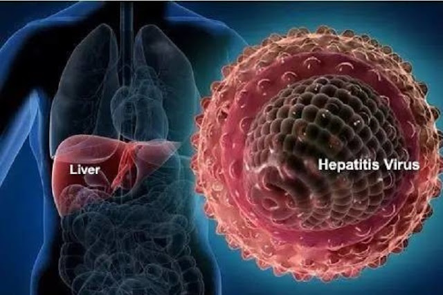 mba mysore university,hepatitis b,hepatitis,Viral Hepatitis Is Due To That,viral hepatitis,hepatitis problem,hepatitis c,hepatitis a,what is hepatitis c,what is hepatitis,hepatitis c symptoms,liver cirrhosis,liver failure,cirrhosis,how do you get hepatitis c ,anatomy,physiology,lifestyle,human anatomy,human physiology,medical,medical science,science,tech,technology