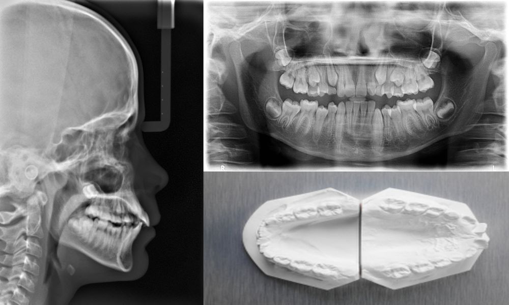 Orthodontic Diagnosis