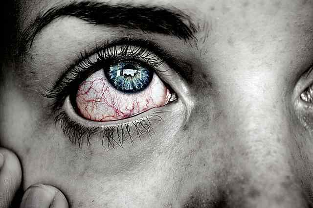 علاج التهاب الملتحمة في العين بالمنزل
