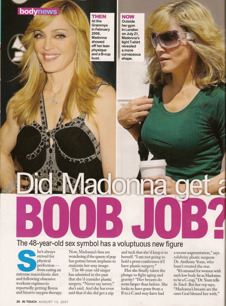 breast augmentation before and after c cup. Madonna efore and after