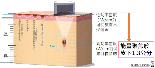 超音波能量聚焦於皮下1.3公分處(原圖引用自官網)-皮理春秋