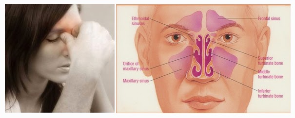 For Sinusitis 7 Weeks